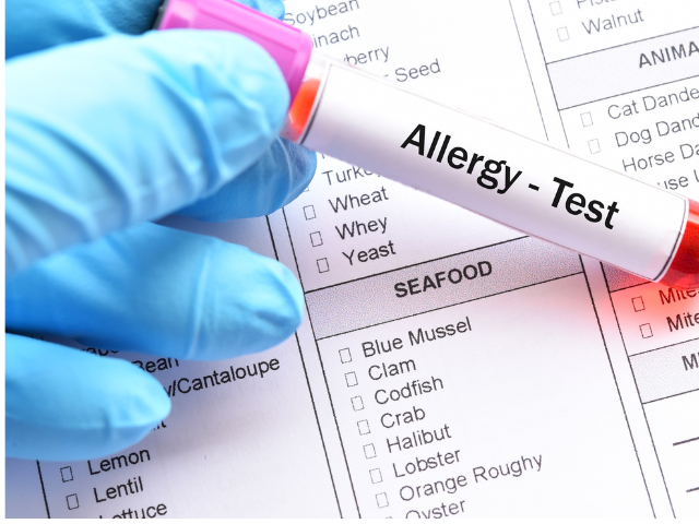 A medical professional holding a vial labeled "Allergy - Test" with an allergy test sheet in the background.